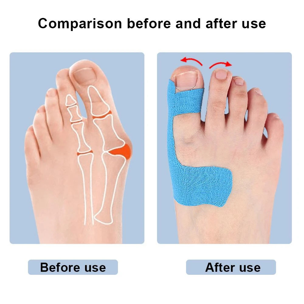 10PCS Precut Kinesiology Tape for Bunion,Bunion Corrector & Relief,Big Toe Support Pain Relief,Hypoallergenic Latex-Free Tape