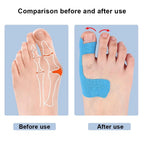 10PCS Precut Kinesiology Tape for Bunion,Bunion Corrector & Relief,Big Toe Support Pain Relief,Hypoallergenic Latex-Free Tape